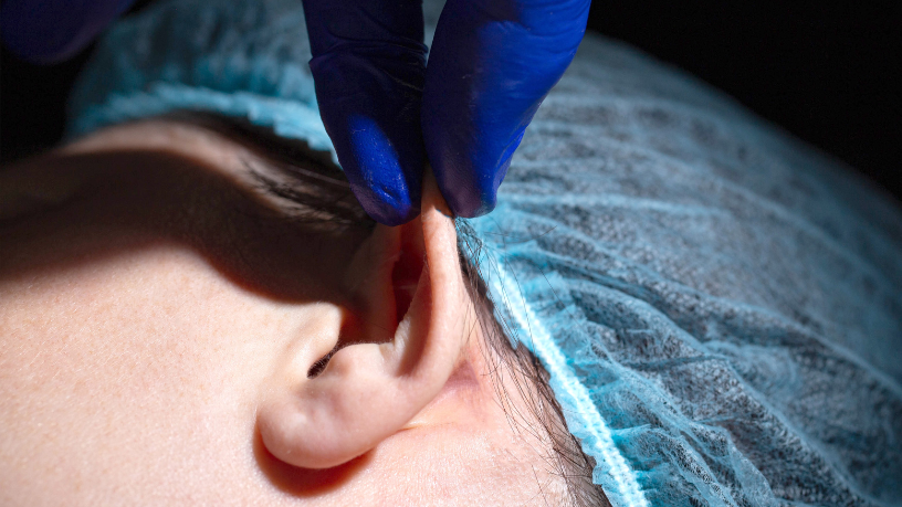 A otoplastia representa recomeço e confiança para muitos pacientes, destaca Dr. Milton Seigi Hayashi.